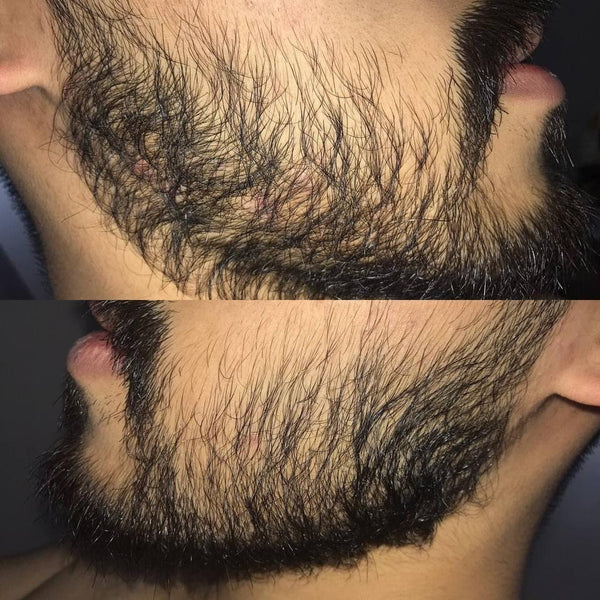 12.5% Minoxidil Customer review by Morgan from the USA